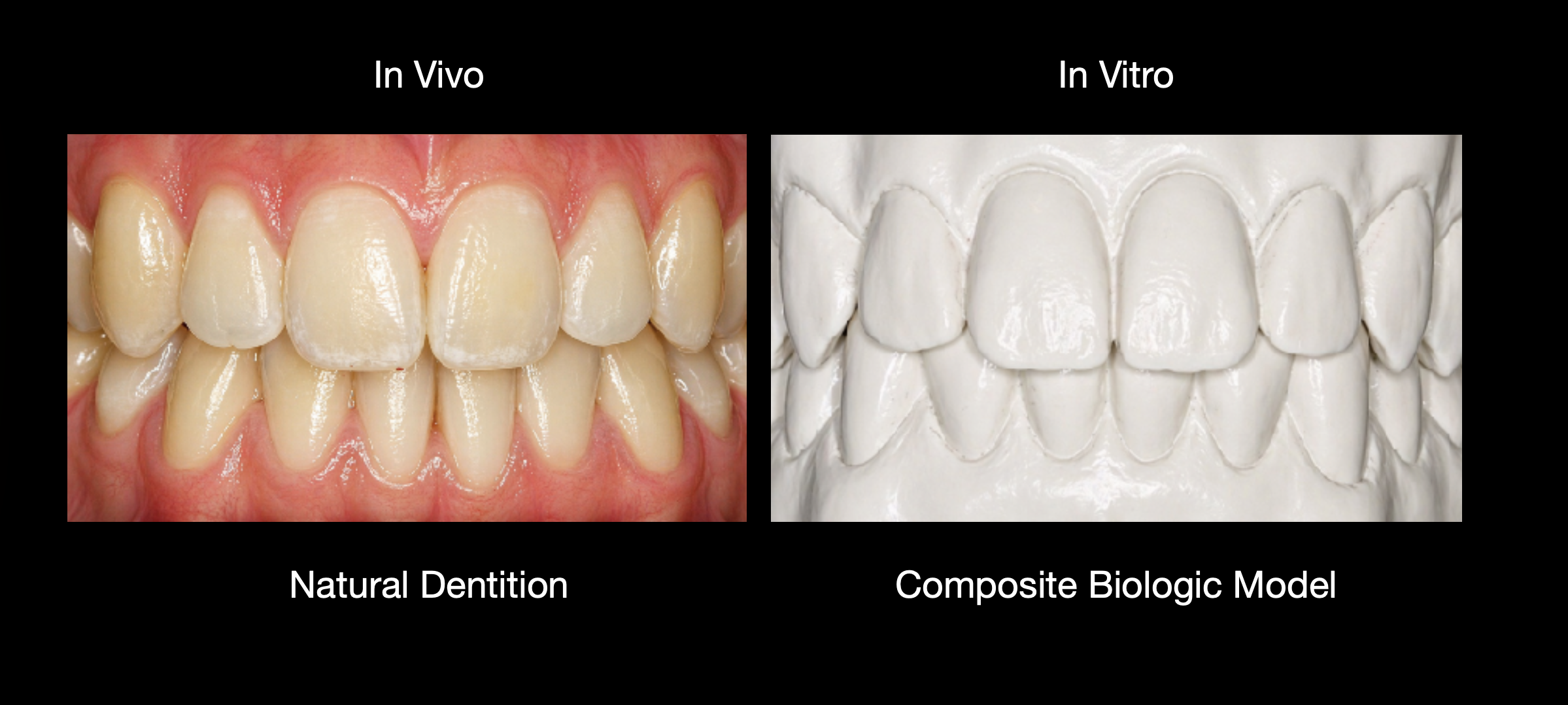 Khớp cắn thuận tự nhiên: Centric Occlusion, Centric Relation và mục tiêu CO=CR