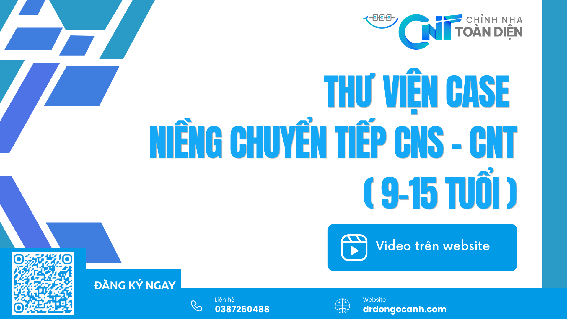 Thư viện case niềng chuyển tiếp CNS – CNT (9–15 tuổi)